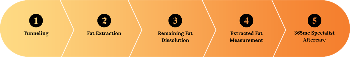 lams in korea - local anesthetic minimally invasive liposuction at 365mc in seoul, south korea